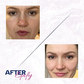 Epify Radiant Glow Face Care Set, Superfruit Post Epilation Papaya Gel, Glutathione Shot with Glutathione & Arbutin, Hair Inhibitor for Face and Body, Gentle Peeling and Hydration