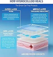 Vista 4 de MasterMo Rollo hidrocoloide para el cuidado de heridas, vendas hidrocoloides extra grandes de grado médico de 2 pulgadas x 16 pies con autoadhesivo