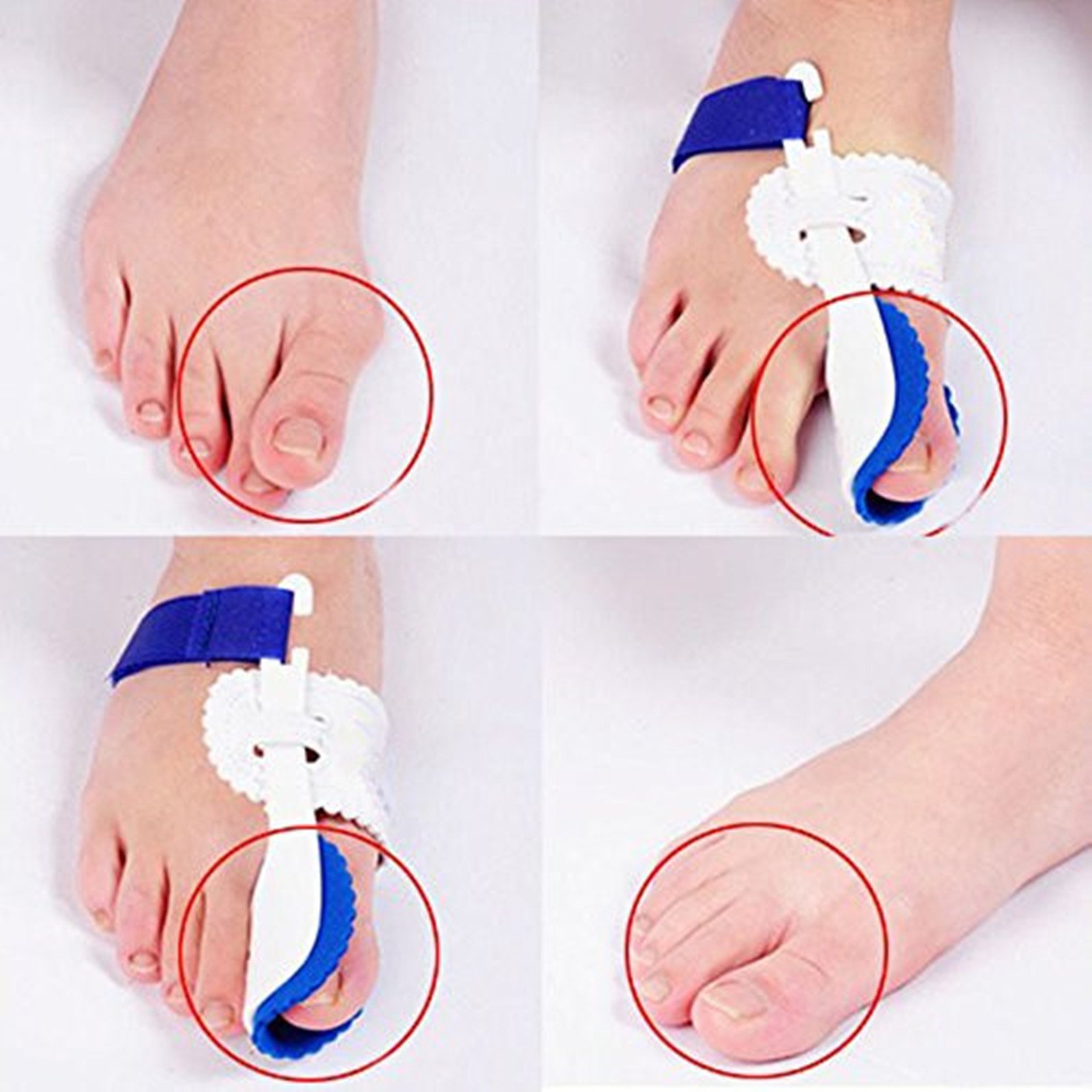 Bunion Night Splint prostownica z dużymi palcami hallux Valgus - 1 para