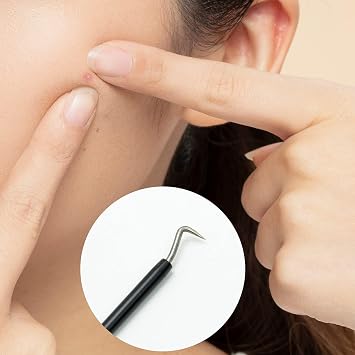 SZXMDKH Black Blackhead Tool Kit, Stainless Steel Acne Needles Double Side Spot Squeezer Tool, Pimple Popper Tool Kit, Whitehead Removal…