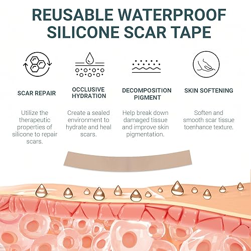 Miniatura 3 de Hojas de silicona para cicatrices para eliminación de cicatrices, cinta reutilizable para cicatrices quirúrgicas, cesáreas, queloides y quemaduras,