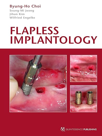 Flapless Implantology (Hb 2010)