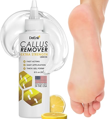 DeEnti - Gel removedor de callos de pies, removedor de callos extra fuerte, 8 onzas, suministros de pedicura para el hogar para piel áspera, seca y