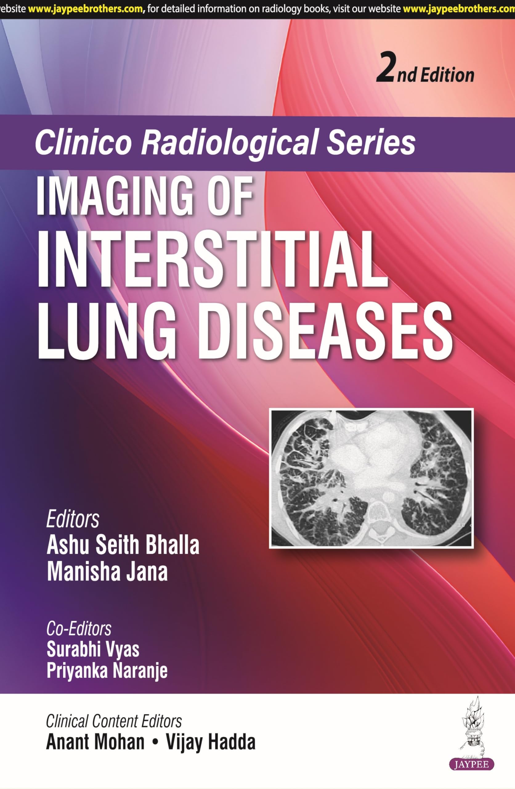 Clinico Radiological Series: Imaging of Interstitial Lung Diseases