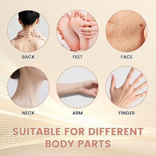 Miniatura 3 de Komzlait Removedor de verrugas para perros, kit de eliminación de verrugas de perro de acción rápida, seguro y fácil de usar, resultados en unos