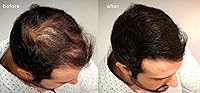 Vista 3 de Fibras capilares voluminizadoras con queratina real para adelgazar el cabello/pérdida de cabello – Dermatológicamente probado y certificado