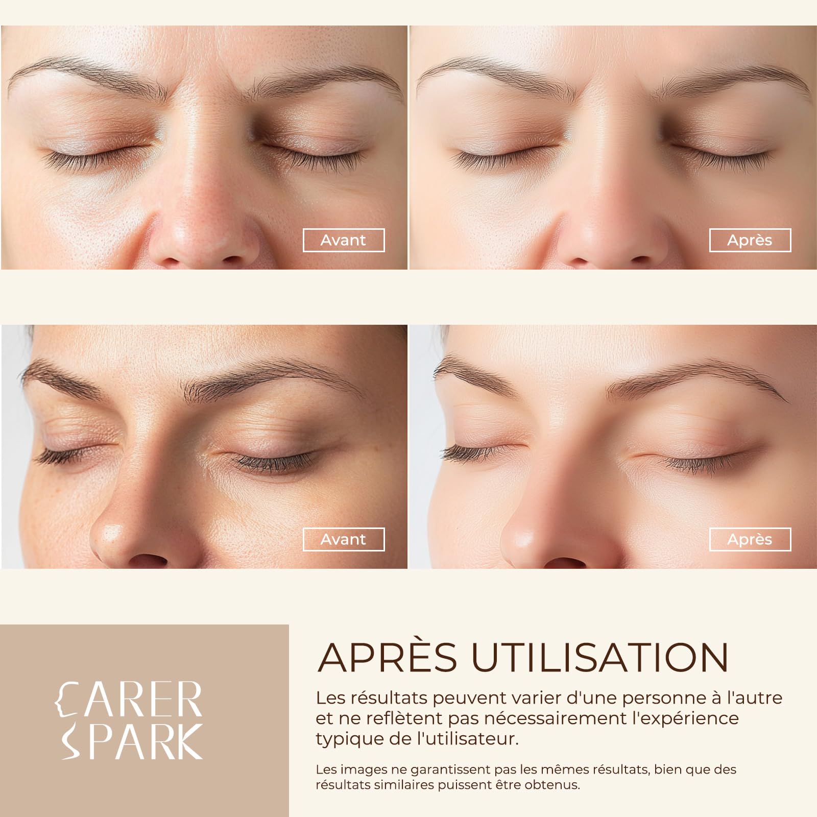 CARER SPARK Épurateur de Peau Ultrasonique - Spatule Visage à Ultrasons EMS Ions Lumière Rouge et Bleue, 4 Modes pour Nettoyage en Profondeur Élimination des Points Noirs Exfoliation Douce
