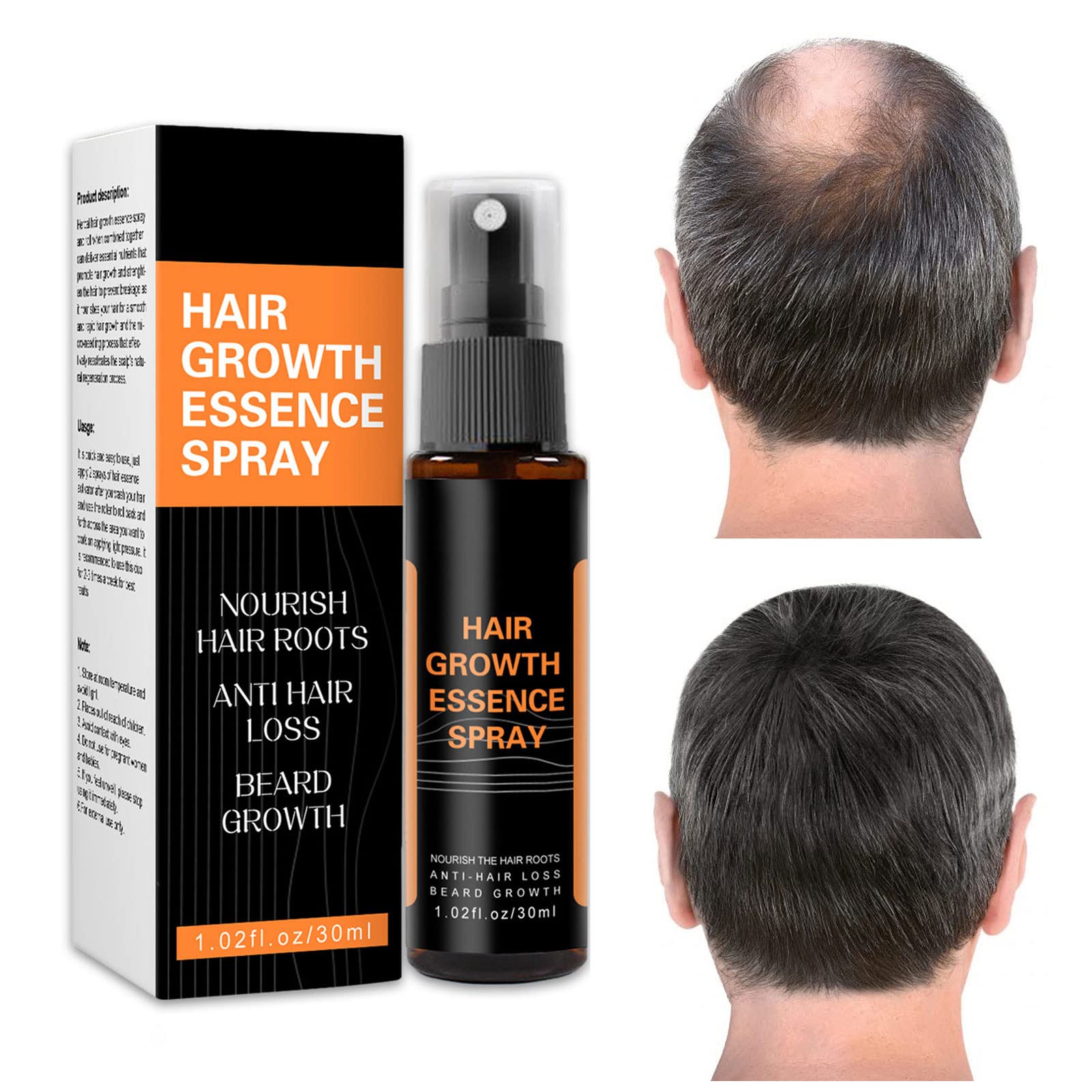 Hair Regrowth Treatments Effective Solutions for Thinning Hair Hair