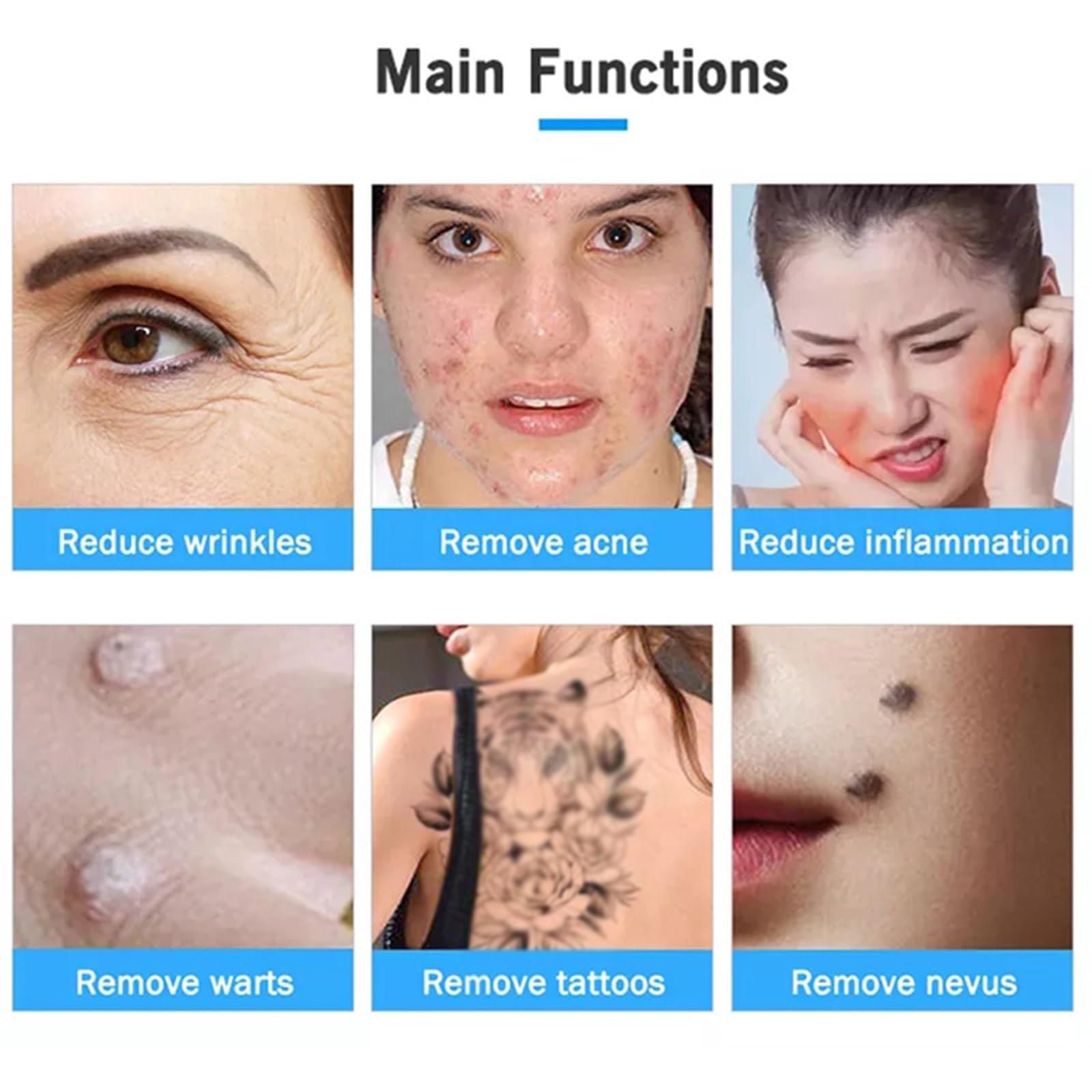 BolíGrafo Profesional para Eliminar Lunares, BolíGrafo De Plasma, con Luz Roja Y Azul para El Cuidado De La Piel, 9 Niveles De Ajuste, Se Utiliza para Eliminar Pecas, Lunares, Verrugas
