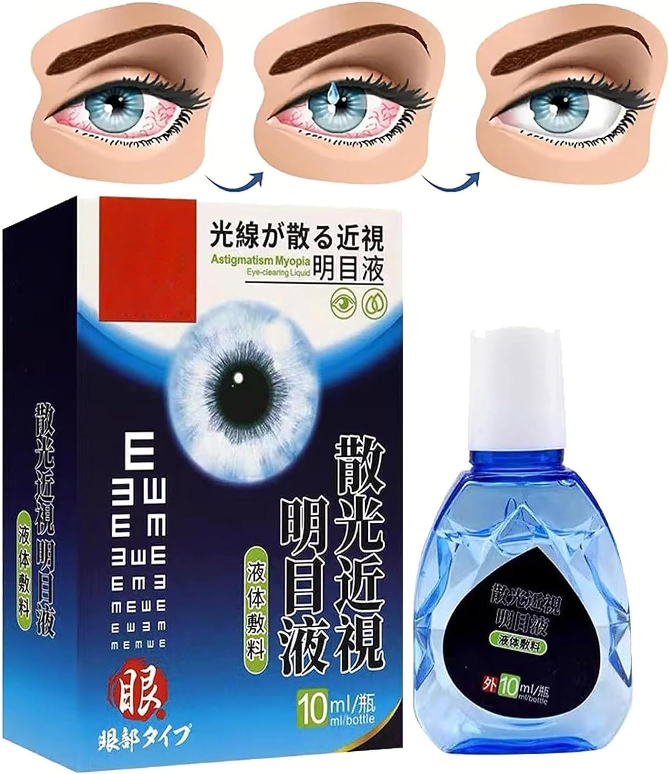 – ATTDX Treatment EyeProblems SolutionDrops, Eye Therapy Drops, Eye Drops for Dry Eyes, Best Moisture Eye Drops, Eye Care Brightening Solution Japanese (1pcs)