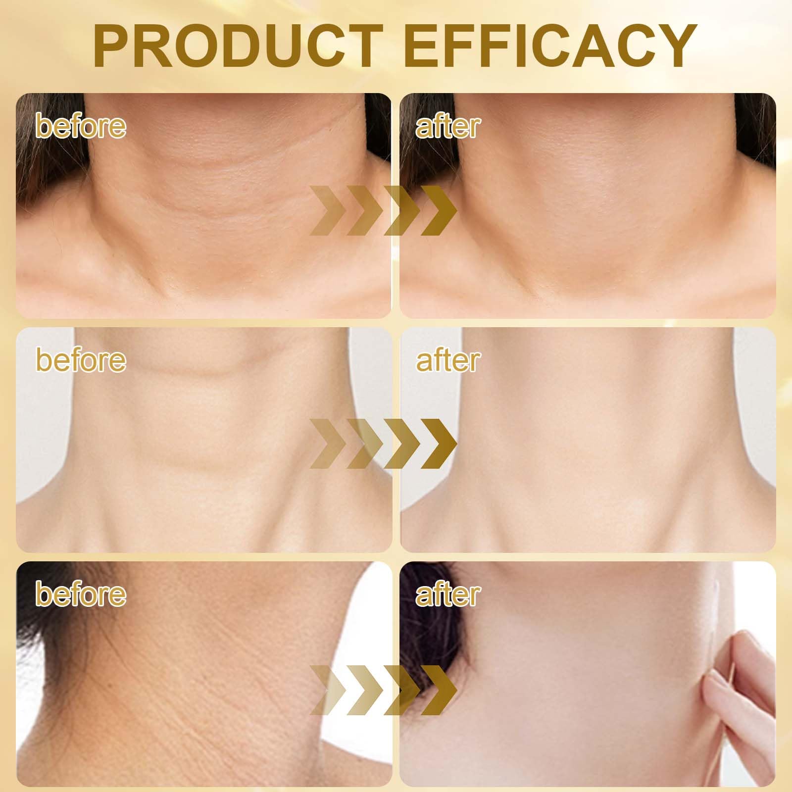 AH-8 Creme Raffermissante pour le Cou, Combattre le Double Menton, Crème Raffermissante avec Rouleau et Patch pour le Cou, Nourrit la Peau