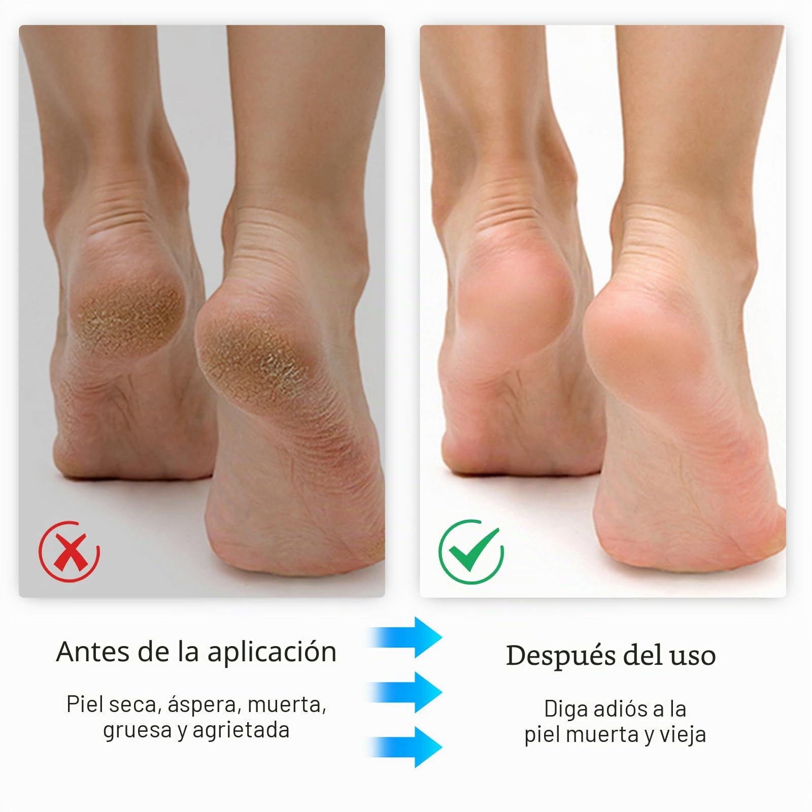 Recortadora de callos eléctrica fuerte – Dispositivo recargable con 3 ruedas de repuesto, cortador profesional para callos de los pies