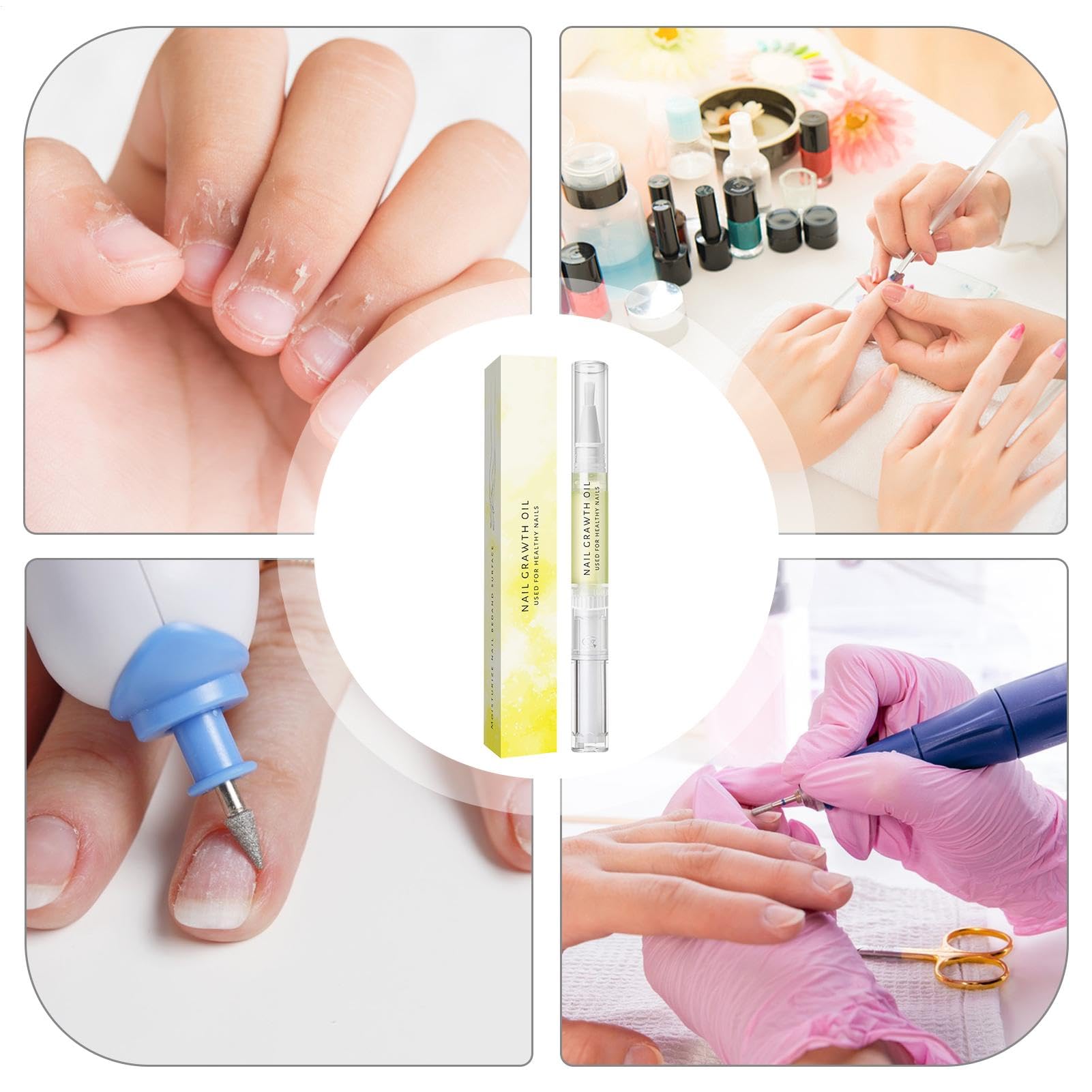 2 Confeziona Olio Per La Crescita Delle Unghie, Olio Di Crescita Delle Unghie Cosmetiche, Con 'albero Del Tè, Vitamina E E Aloe, Per Idratare E Riparare