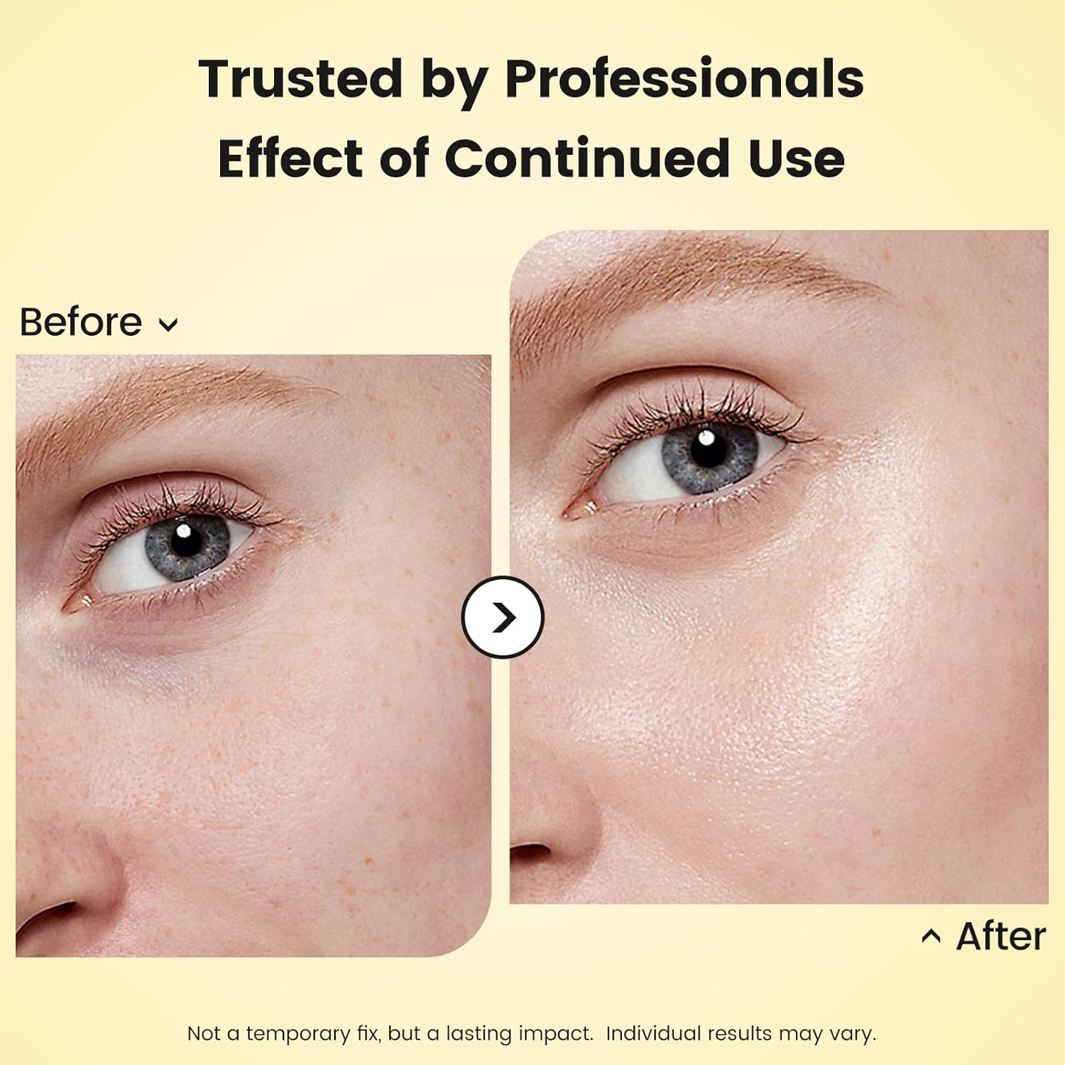 Lynz Pure Vitamin Illuminating Serum, Illuminating Vitamin C Serum Blend with Niacinamide Revitalize Complexion, Boosts Skin Barrier Resilience, Deeply Hydrates for Daily Use 1 Fl Oz - Image 4