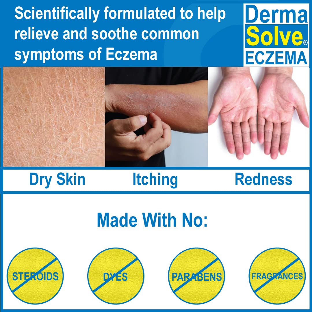 Dermasolve Eczema Relief Shampoo (2-Pack) | Eczema Flare Control Scalp & Dandruff Relief Therapy That Protects, Moisturizes, and Repairs Skin Kids, Babies & Adults - Steroid Free (Shampoo 2-Pack)