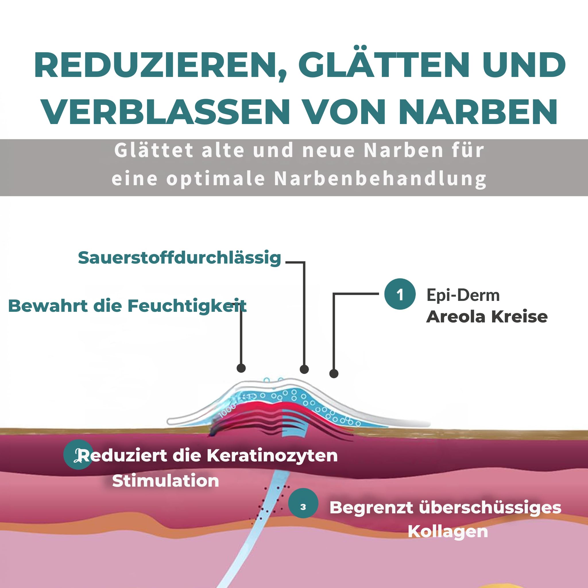 BIODERMIS Epiderm Natural plaster do leczenia blizn w kolorze skóry, na klatkę piersiową, 1 x 2 sztuki, folia silikonowa na blizny, silikonowy plaster na blizny