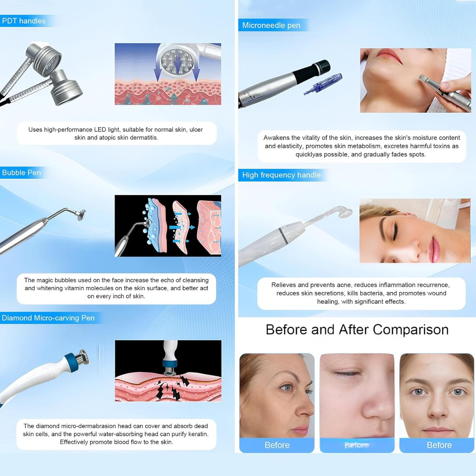 14 en 1 Máquina de Belleza | Hidrofacial Profesional | Limpieza Facial Profunda & Reafirmación | Hidropeeling, Microdermoabrasión y Oxigenoterapia | para SPA,Salón y Uso en Casa