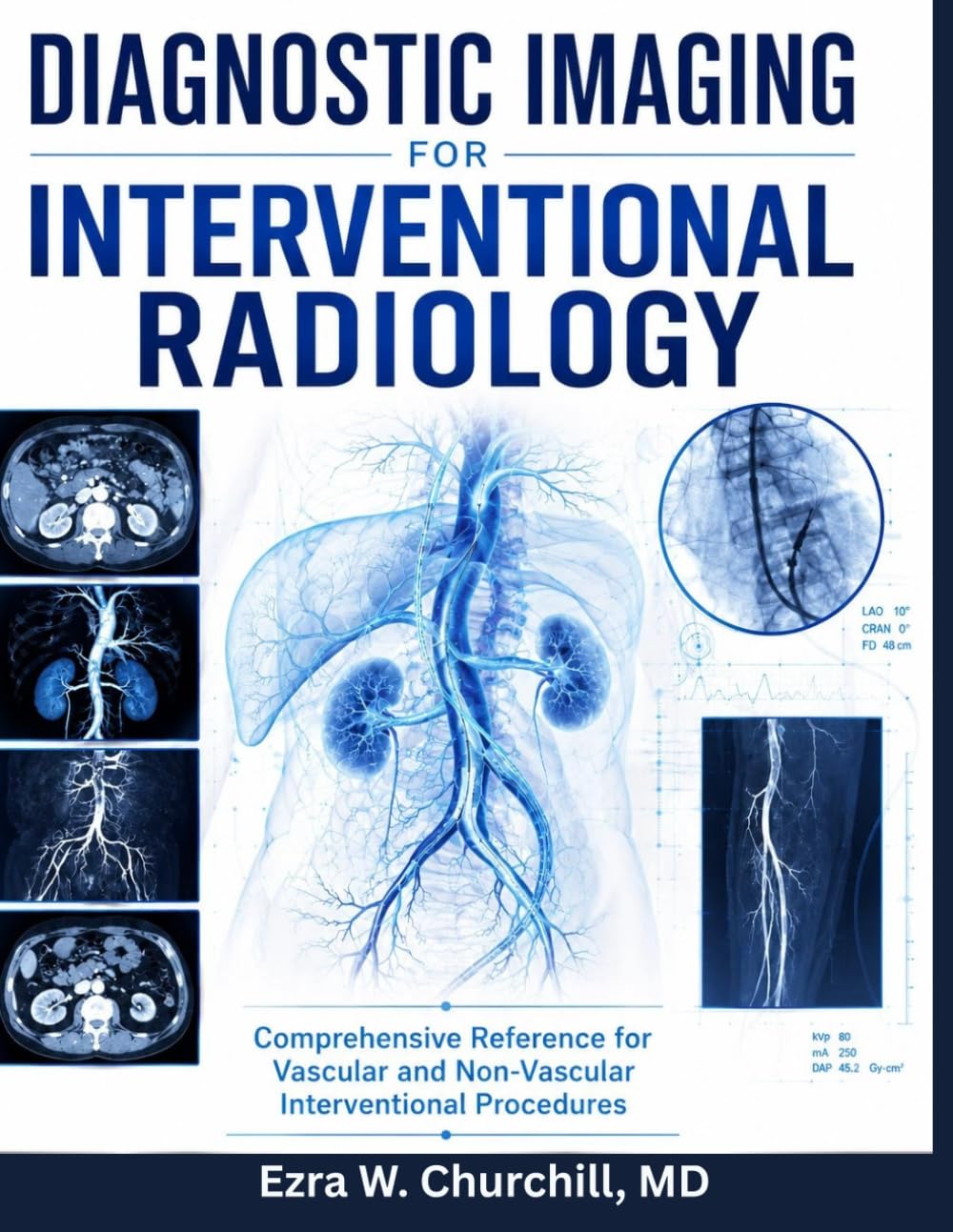 Diagnostic Imaging for Interventional Radiology: Comprehensive Reference for Vascular and Non-Vascular Interventional Procedures