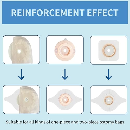 Miniatura 4 de Tiras de barrera para ostomía, cinta de barrera para ostomía en forma de Y, tiras de barrera elástica, tiras de barrera adhesiva de grado médico,