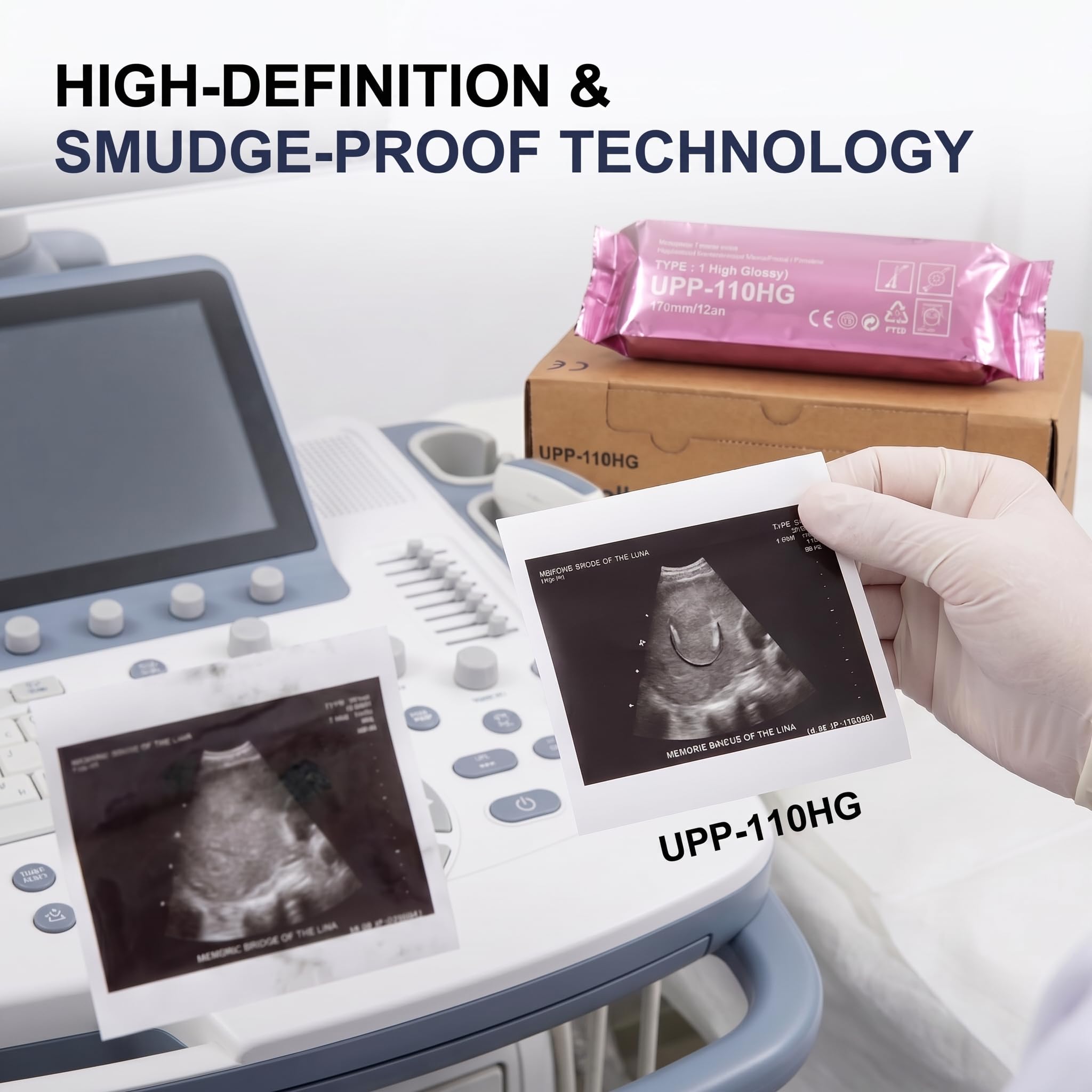 Amazon.co.jp: 超音波紙UPP-110HG、高光沢感熱媒体、110mm x 18m、10