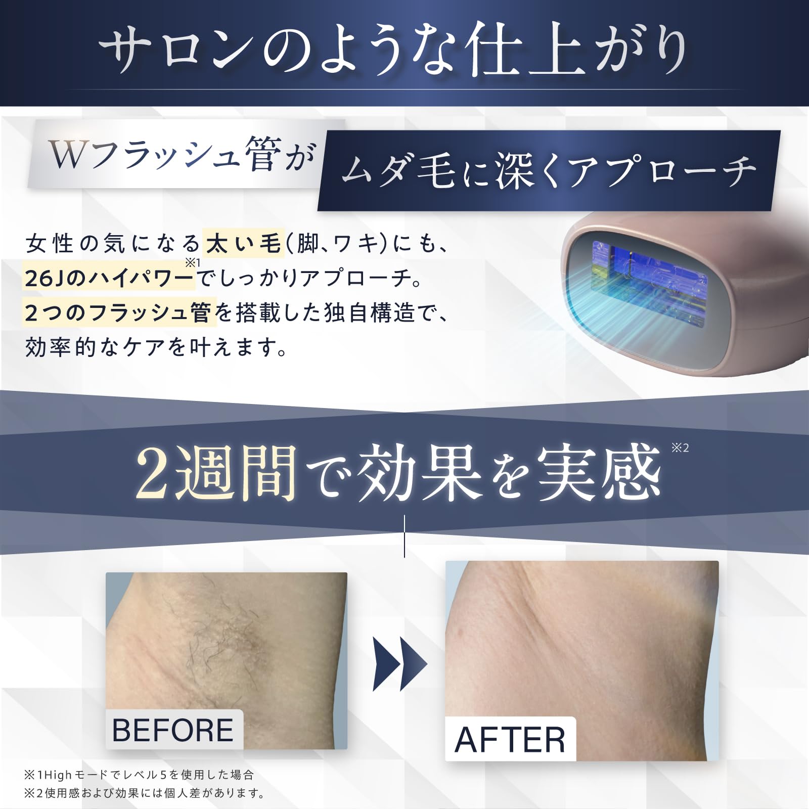 Amazon | 脱毛器 VIO対応 家庭用脱毛器 レディース 光脱毛器