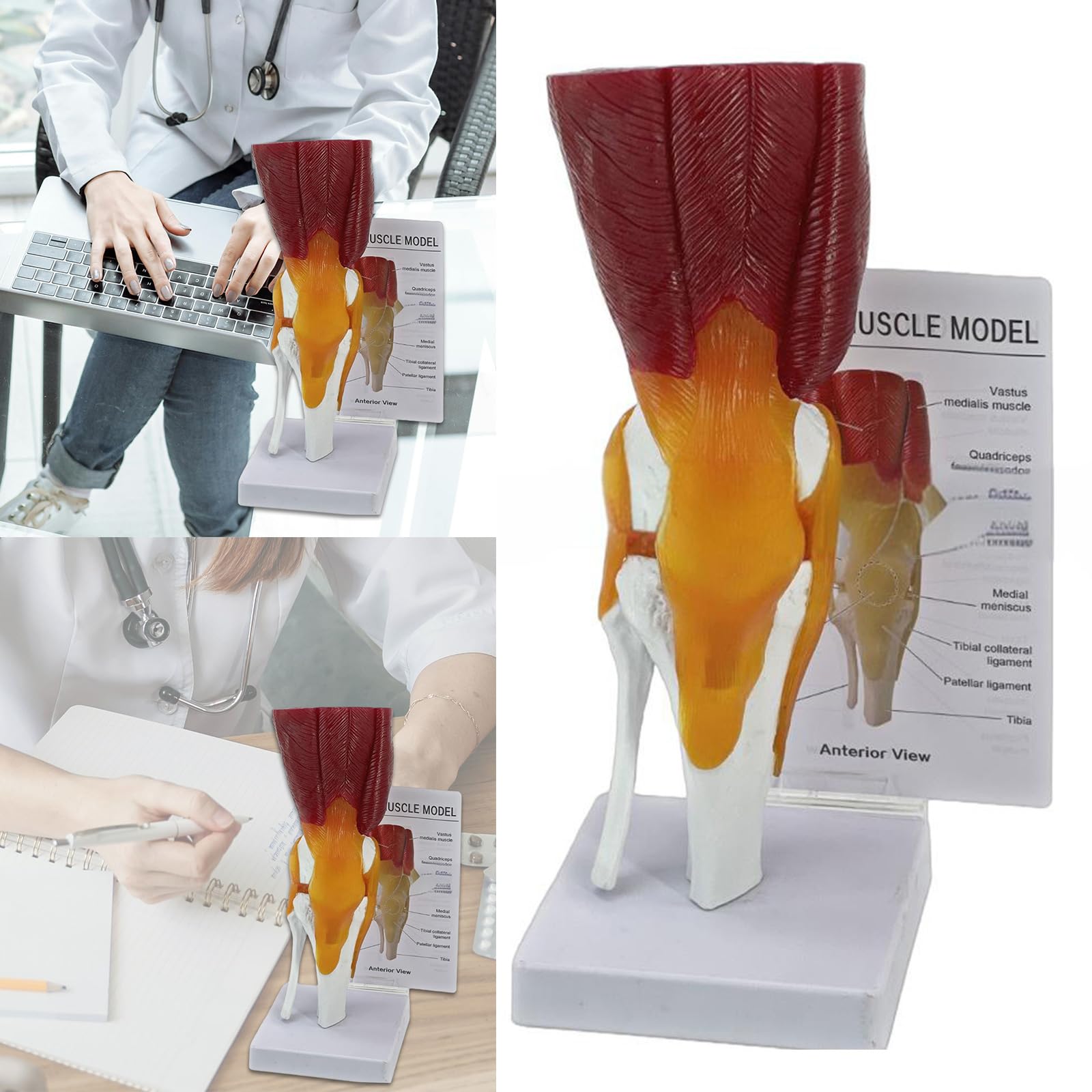 Modello articolazione del ginocchio per visualizzazione didattica Modello pratico anatomia del ginocchio umano con legamenti Materiale scolastico Articolazione umana per l ' educazione scientifica