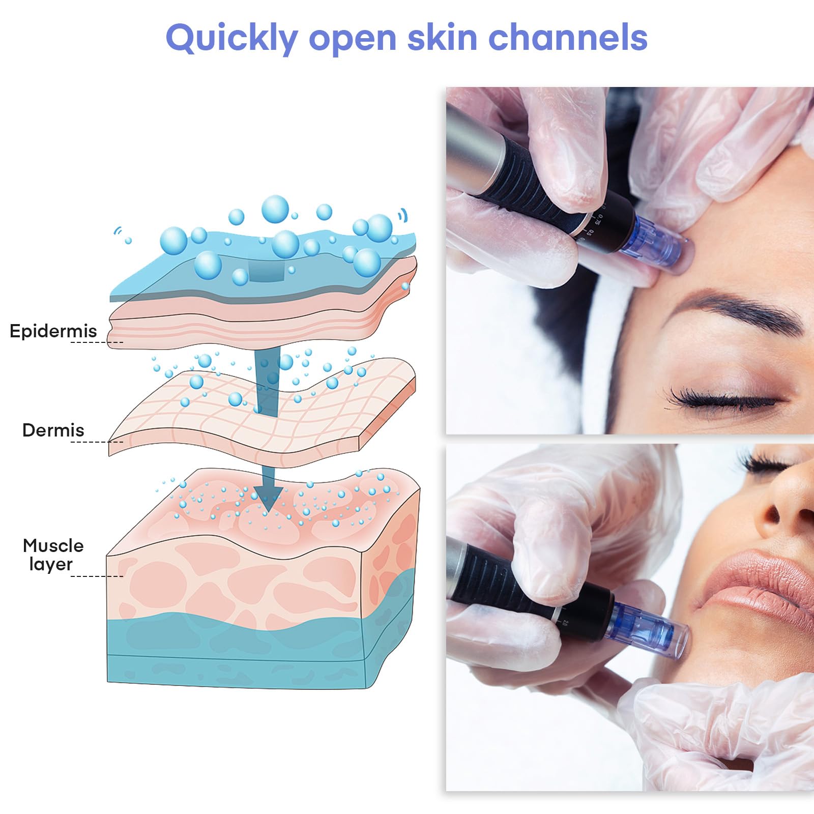 Aghi microneedling 36 punte, Dermapen Microneedling cartucce di ricambio per Derma Pen A6/A10, Cartucce Needling viso con fessura a baionetta (20 pezzi)