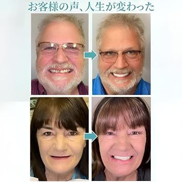 Silicone Denture Set, One-touch Teeth, Eating Instant, Total Denture, Adjustable, Natural Smile, Easy to Clean, Comfortable Design, Easy to Wear, Repeatedly, For Men and Women, For Upper and Lower