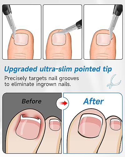 Miniatura 4 de Cortaúñas, cortaúñas para uñas encarnadas o gruesas, cortaúñas para hombres, mujeres y personas mayores con hoja recta de acero inoxidable, cortador