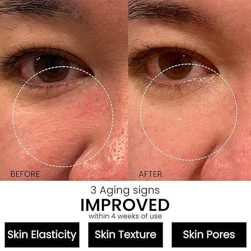 Miniatura 2 de Suero de retinol al 2.5% para el rostro antienvejecimiento con ácido hialurónico para minimizar las arrugas. Mejora la piel dañada por el sol y