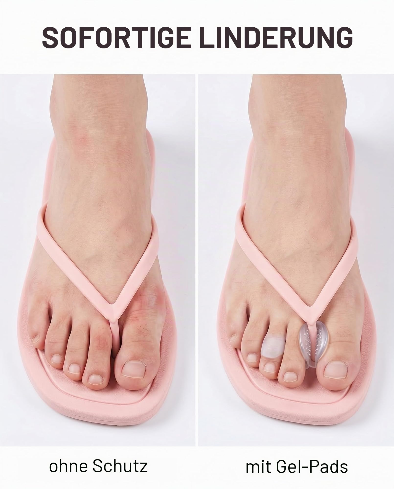 Zehenschutz Flip Flop Vorfußpolster 8 St. transparent Gel Silikon – Gegen Reibung, Blasen & Schmerzen in Sandalen, High Heels & Zehentrennern.