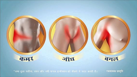 Itch Guard for Itching & Rashes 25gm (Pack of 4) - Pamherbal