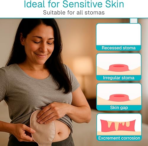 Miniatura 4 de Vive 10 anillos de barrera para ostomía  Barrera de piel moldeable de 0.118 pulgadas para bolsa de ostomía drenable  Suministros de ostomía de grado
