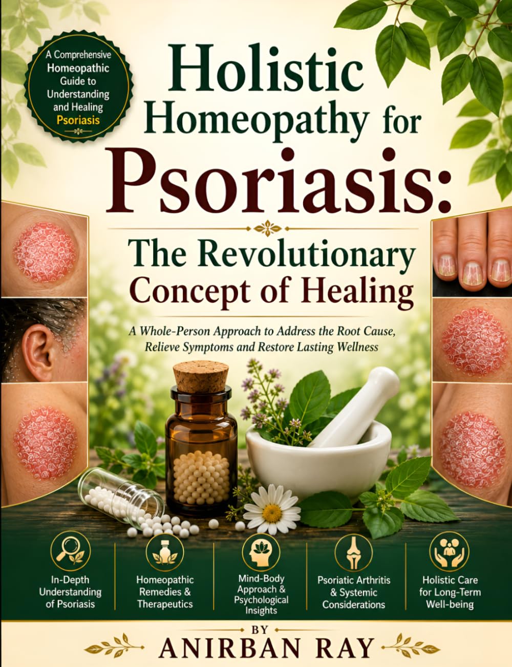 Holistic Homeopathy for Psoriasis: The Revolutionary Concept of Healing