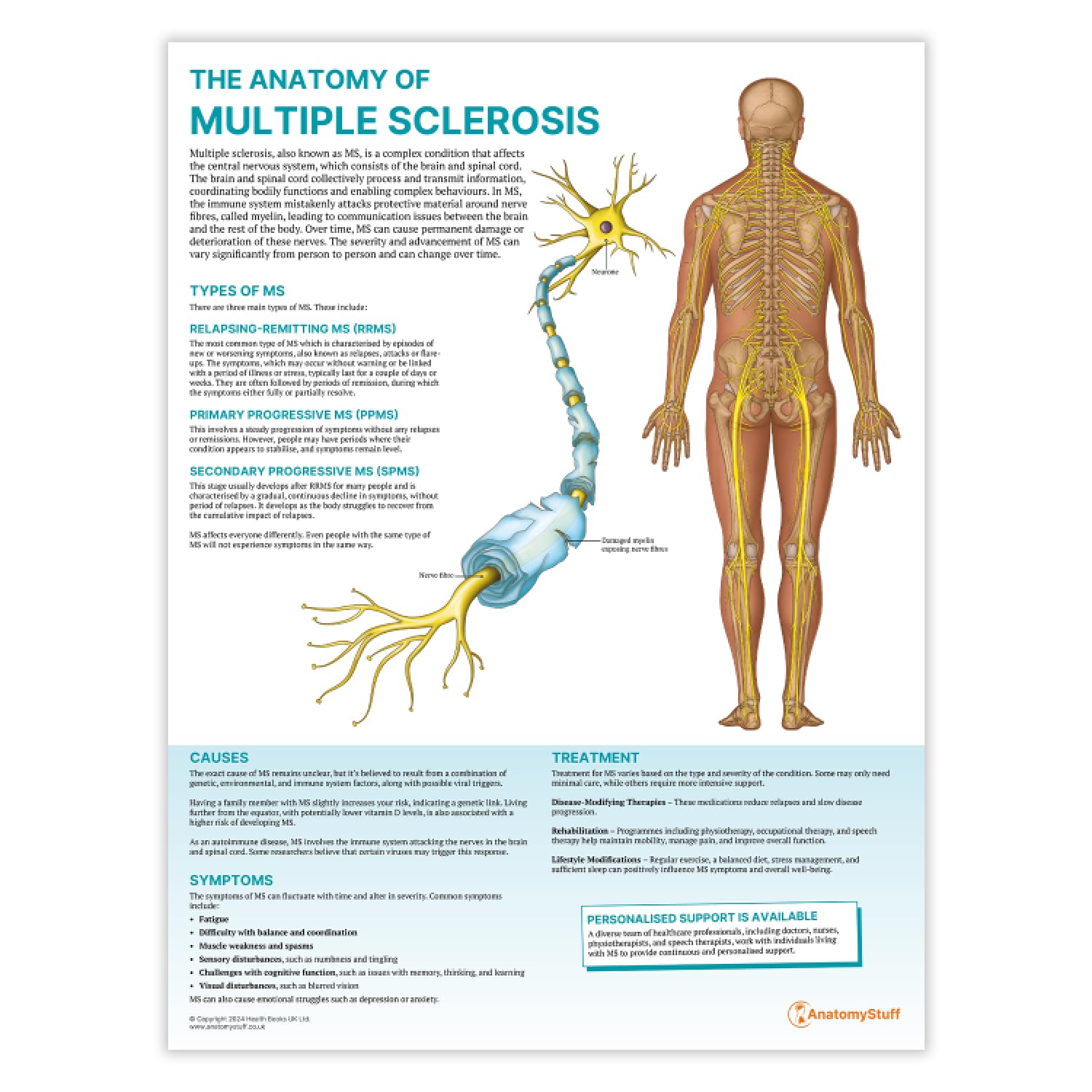 Anatomy Stuff Multiple Sclerosis The Anatomy Of Poster, 45X60 Cm, 18X24 Inches, Ms Anatomy Wall Diagram, Patient Education Chart