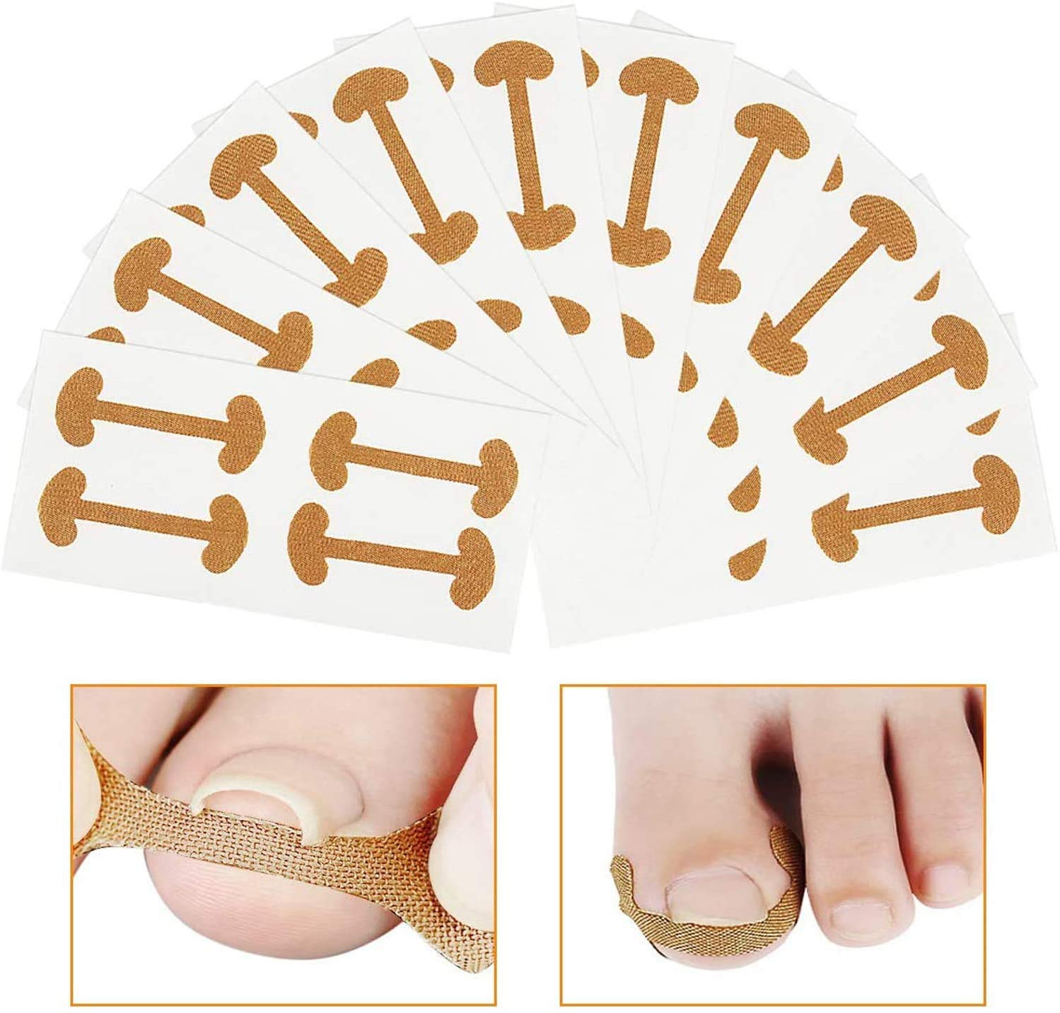 Lifreer 40 PCS Glue Free Toenail Patch, Ingrown Toenail Correction Stickers for Foot Care Treatment Corrector Pedicure Tools Keep Nails Healthy Relieve Pains