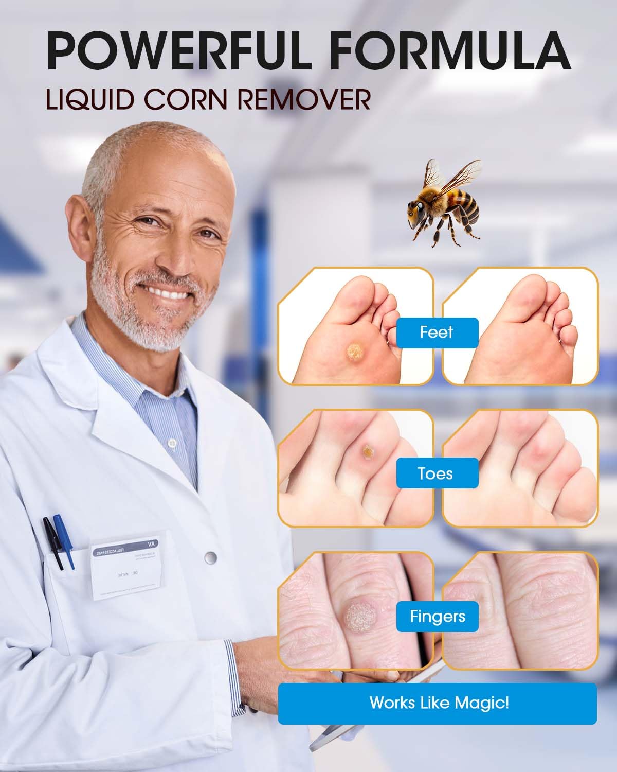 Bee Venom Callus środek do usuwania 20 ml wysoce skuteczny środek do usuwania modzeli na palce, szybko działający płyn dla dorosłych, osób starszych, nastolatków, biegaczy, turystów
