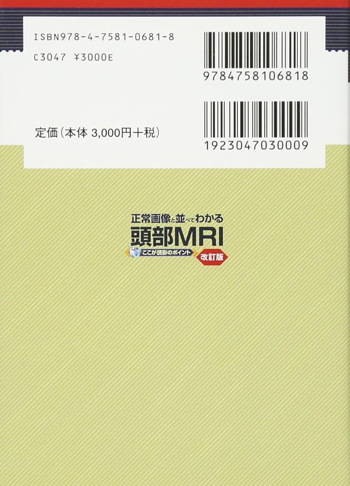 正常画像と並べてわかる頭部MRI―ここが読影のポイント | 土屋 一