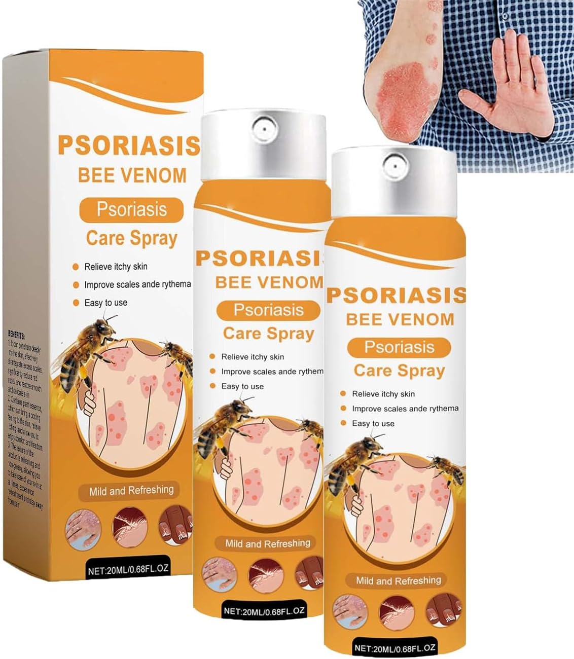 Furzero Psoriaheal Bee Venom Psoriasis Treatment Spray, Furzero Psoriasis Treatment Spray,Bee Venom Psoriasis Spray for Skin Cleansing,Nature Herbal Moisturizing (2 Pcs)