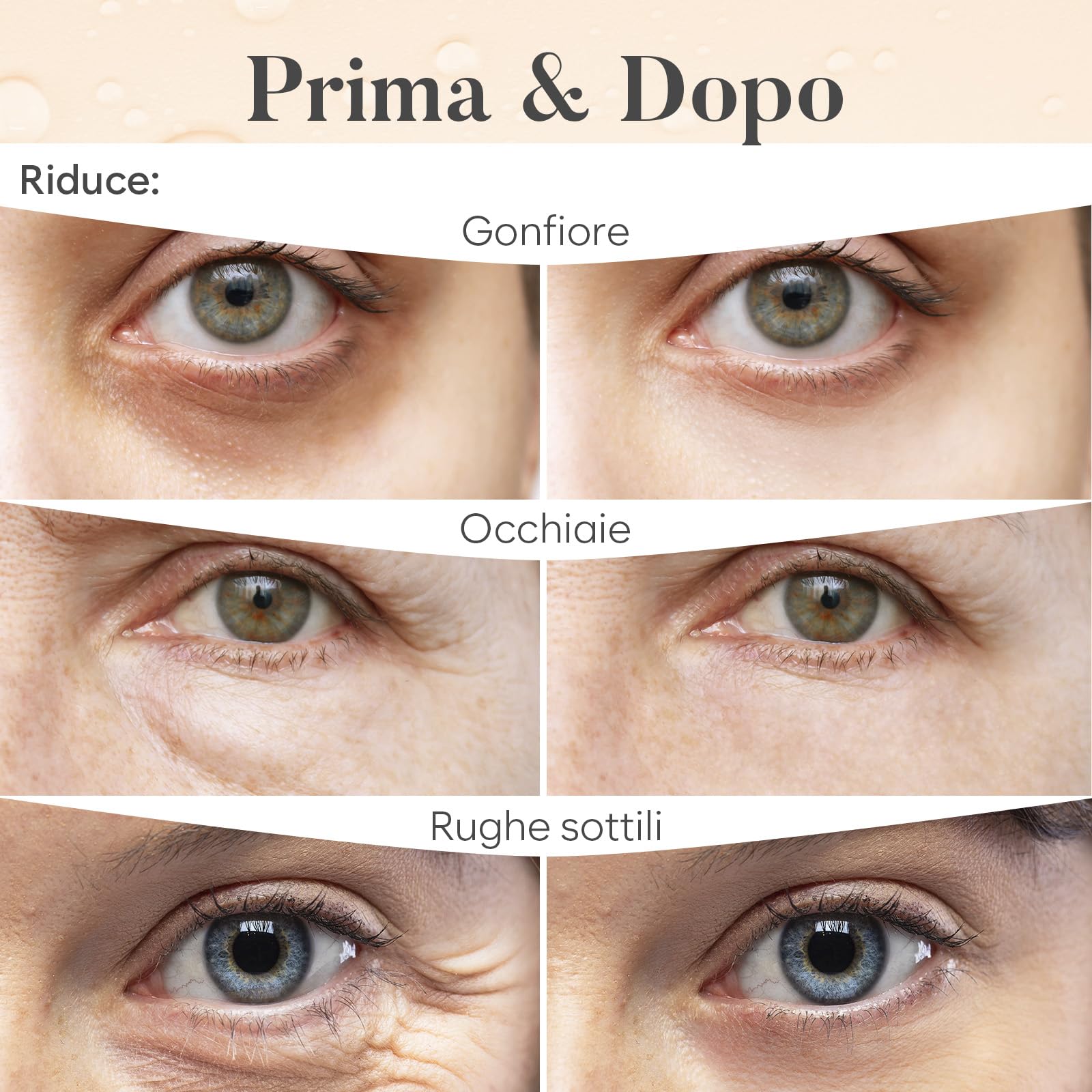 AURAE Patch Occhi (30 paia, mix varietà) – Patch Occhiaie e Borse con Niacinamide + Acido Ialuronico, Effetto Rinfrescante, Idratazione Intensa, Ideali Mattina/Notte