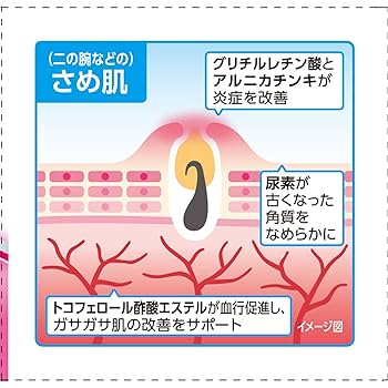 Amazon | 【第3類医薬品】ケラチナミンコーワクロザラエイド 60g