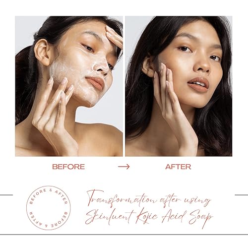 Miniatura 8 de Skinluent Jabón ácido Kojic para aclarar la piel, manchas oscuras, hiperpigmentación y tono desigual de la piel con ingredientes, ácido kójico,