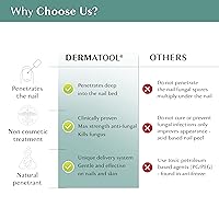 Vista 6 de Tratamiento de hongos en las uñas de los pies, solución antifúngica extra fuerte y tratamiento de hongos en las uñas de los pies – Repara uñas