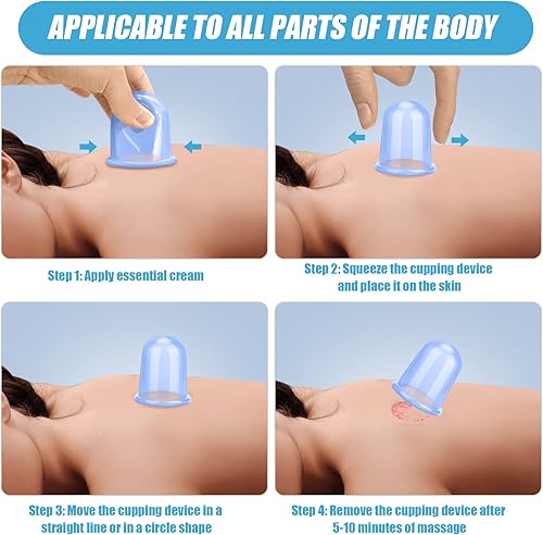 Vista 5 de Juego de terapia de ventosas 7 piezas de silicona anticelulítica ventosa al vacío copa de masaje azul juegos de ventosas faciales kit de masaje