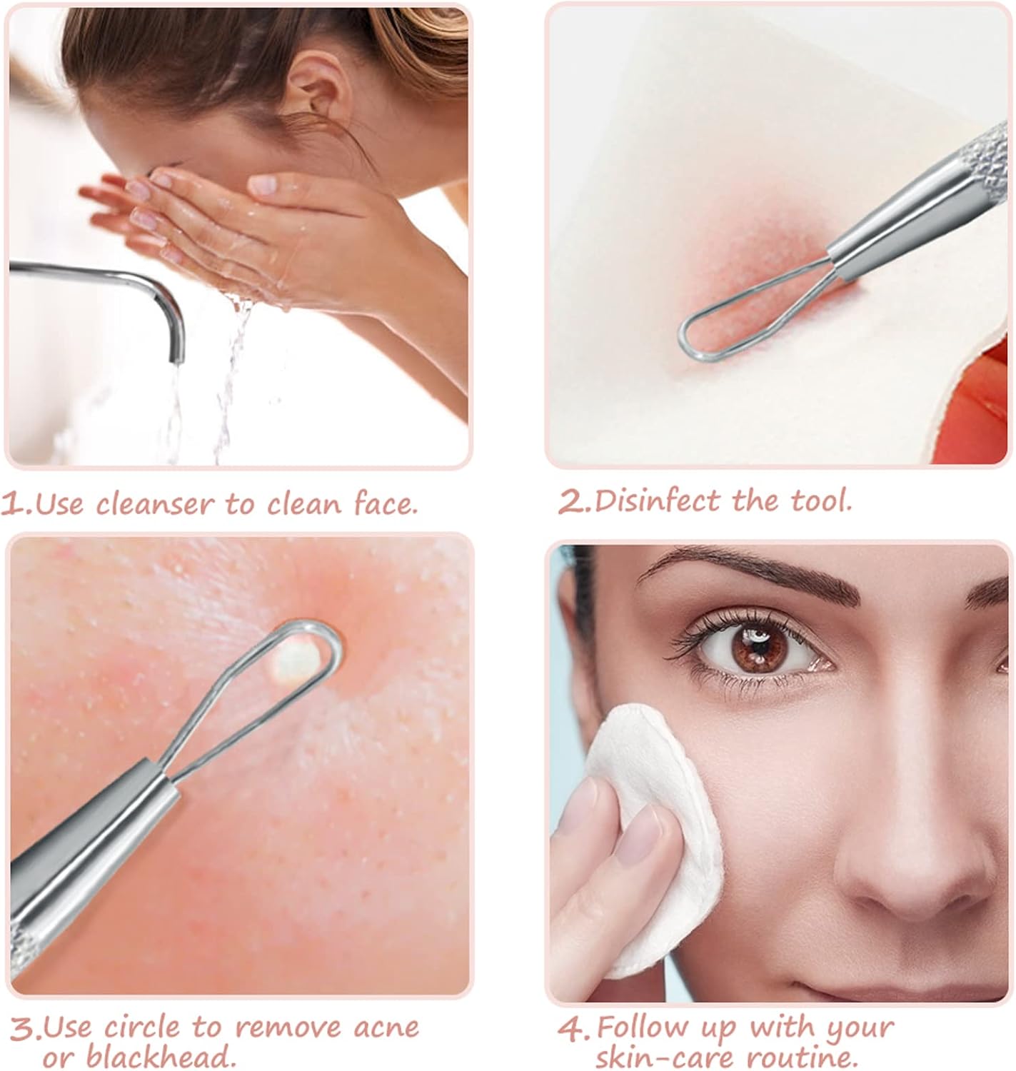 Big Blackheads: What To Expect From Professional Extractions - f9q87ke