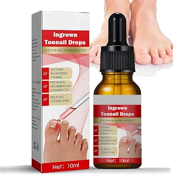 Ingrown Toenail Treatment Drops, Ingrown Toenail Treatment Cuticle Care Oils for Ingrown Toenails Trimming Toenail Softening Drops Natural Ingrown Toenail Correction Fungal Nail