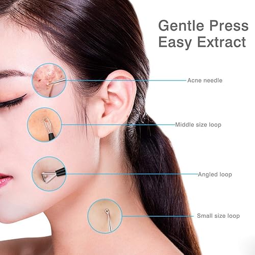 Miniatura 5 de JPNK Herramienta para eliminar puntos negros, kit de eliminación de acné para manchas, estallidos de puntos blancos, 6 piezas de eliminación de
