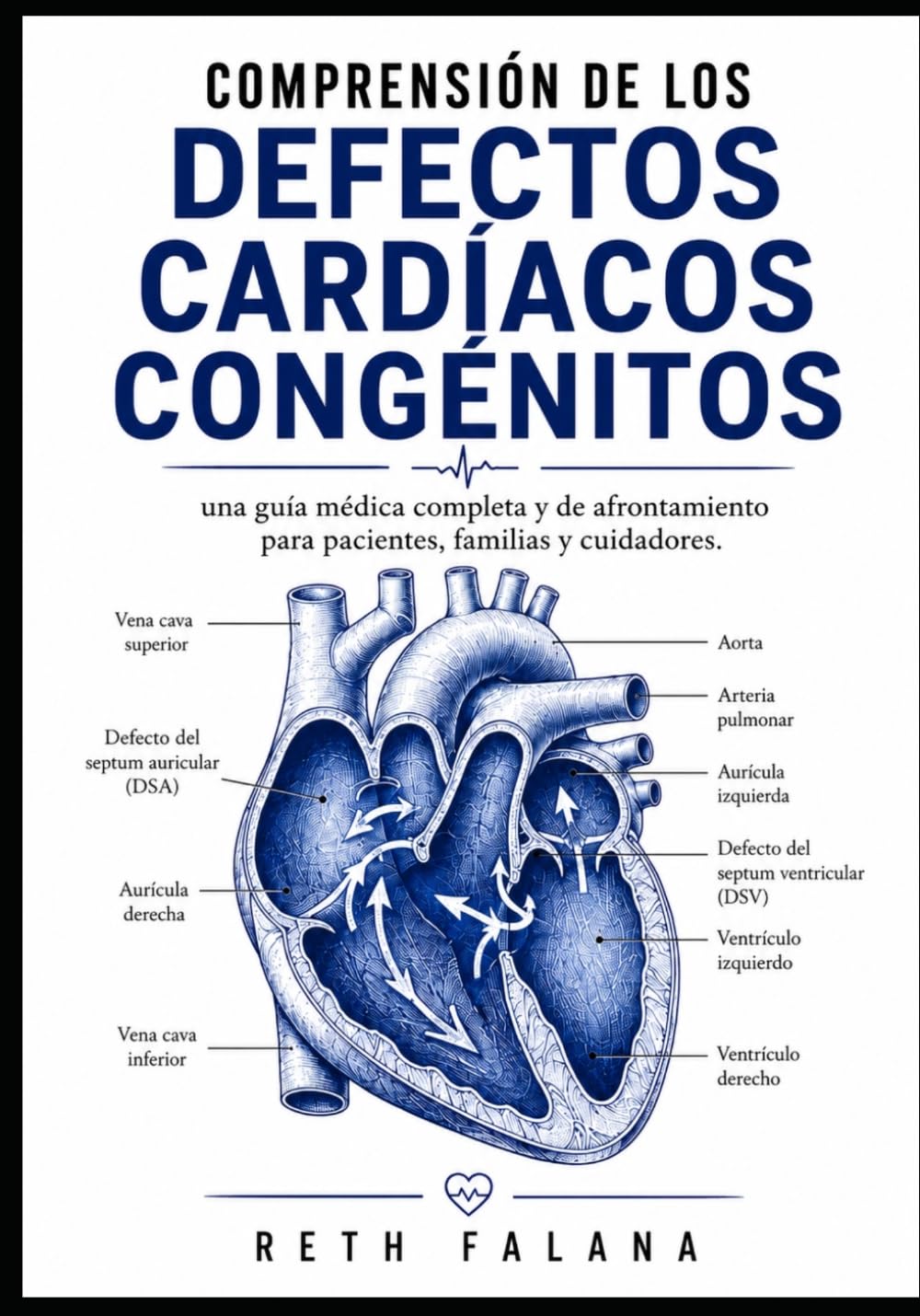 Comprensión de los defectos cardíacos congénitos: una guía médica completa y de afrontamiento para pacientes, familias y cuidadores. (Serie Guía de ... Explicación de las Afecciones Cardíacas)