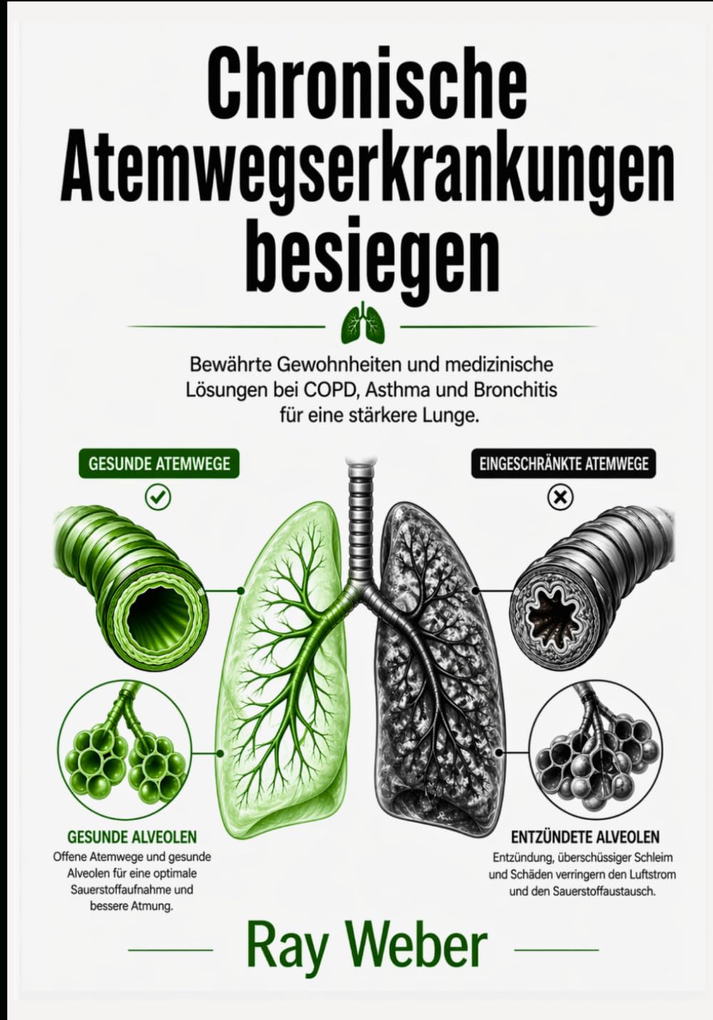 Chronische Atemwegserkrankungen besiegen: Bewährte Gewohnheiten und medizinische Lösungen bei COPD, Asthma und Bronchitis für eine stärkere Lunge. ... Bewältigen. Das Leben zurückgewinnen.)