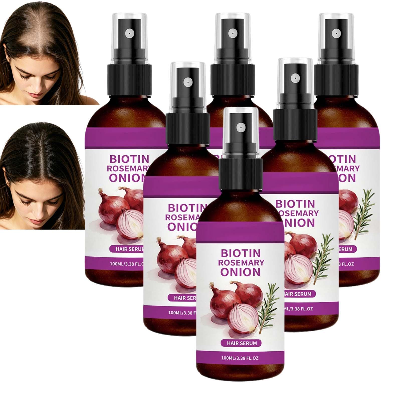 Spray per capelli 3 in 1 alla cipolla e al rosmarino favorisce la crescita, spray per capelli con biotina, rafforza le radici, rivitalizza il cuoio capelluto, spray per capelli al rosmarino, nutriente
